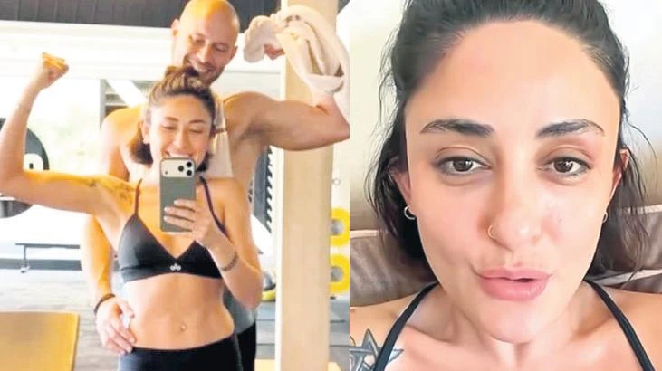 Mosso, spor salonu pozuyla beğeni aldı, gözündeki şişlik dikkat çekti