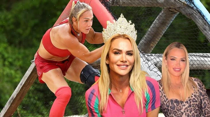 Survivor Nagihan Karadere estetik sonrası yeni görünümüyle dikkat çekti